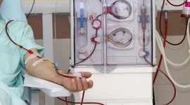 Tamoxifeno, opción para fibrosis peritoneal grave en la diálisis